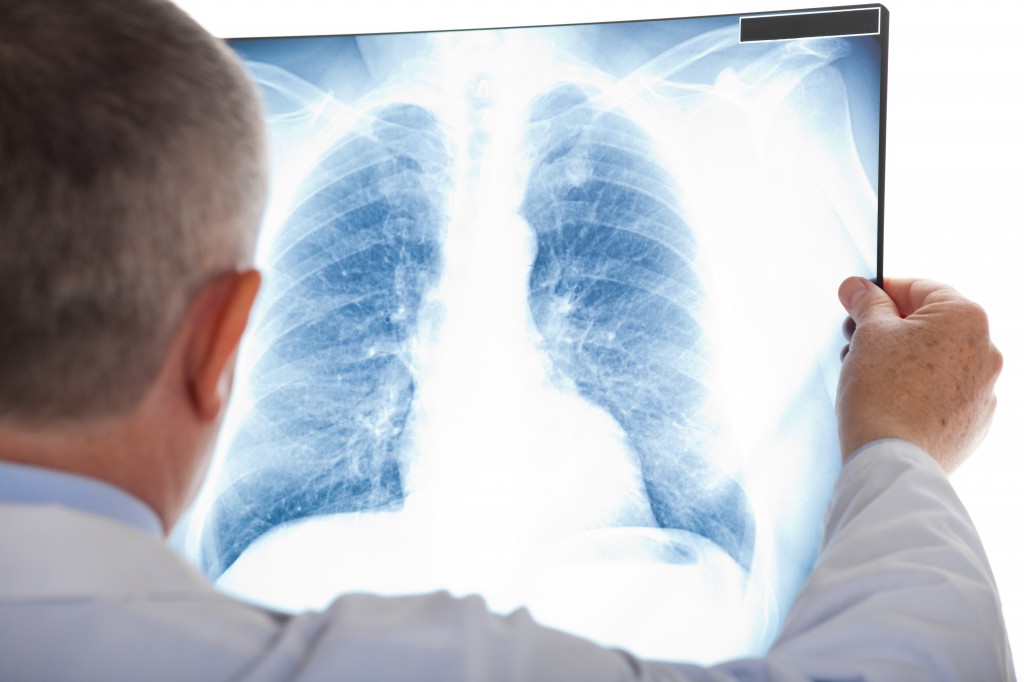 NYC PCP | Internal Medicine Upper East Side | Chest X- Ray